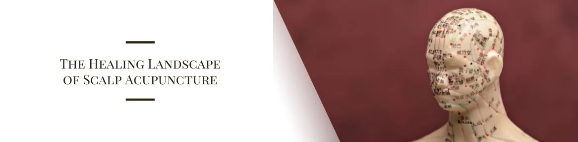 The Healing Landscape of Scalp Acupuncture
